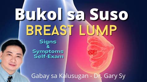 Bukol sa Suso (Breast Lump) .
